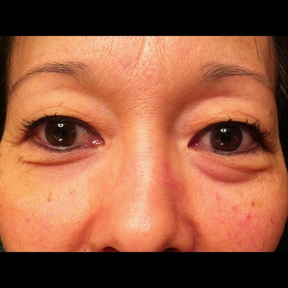 Save an extra 10% off the eye serum - Picture 2 of 3