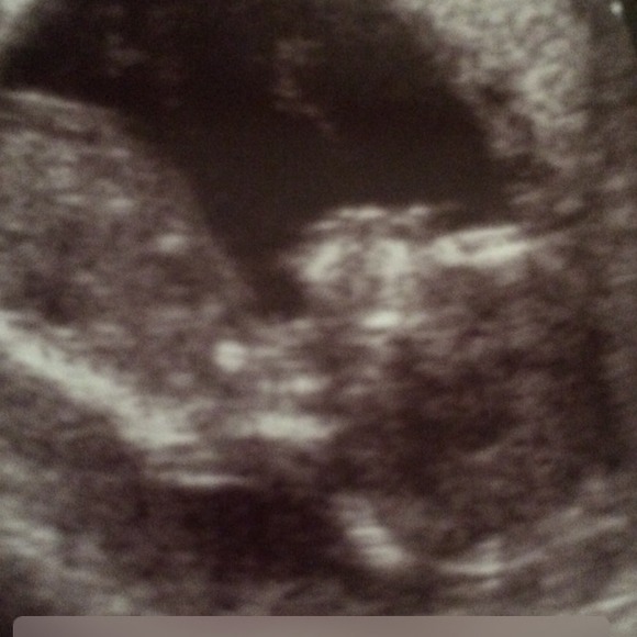 My babyboy❤️❤️❤️❤️