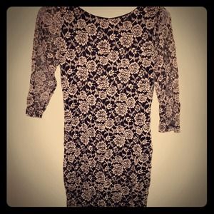 😍 Hot lace dress 😍