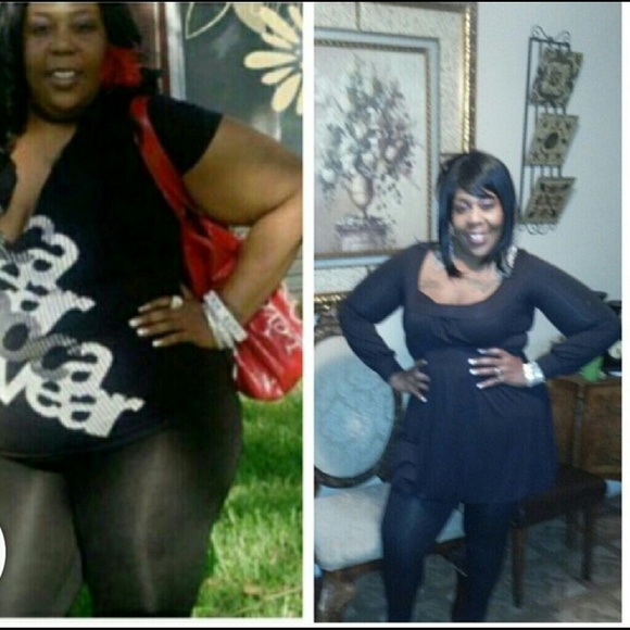 Weight loss garments