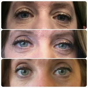 NERIUM AD AGE DEFYING TREATMENT