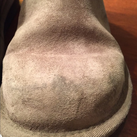 Toe pictures