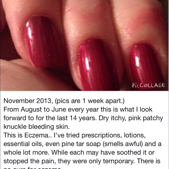 Handmade soap! Treat eczema & pyrosis! 12.00/bar. - Picture 3 of 4