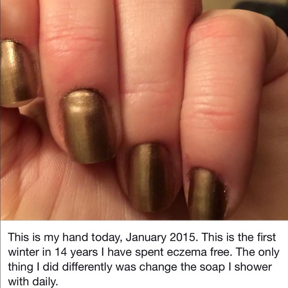 Handmade soap! Treat eczema & pyrosis! 12.00/bar. - Picture 4 of 4