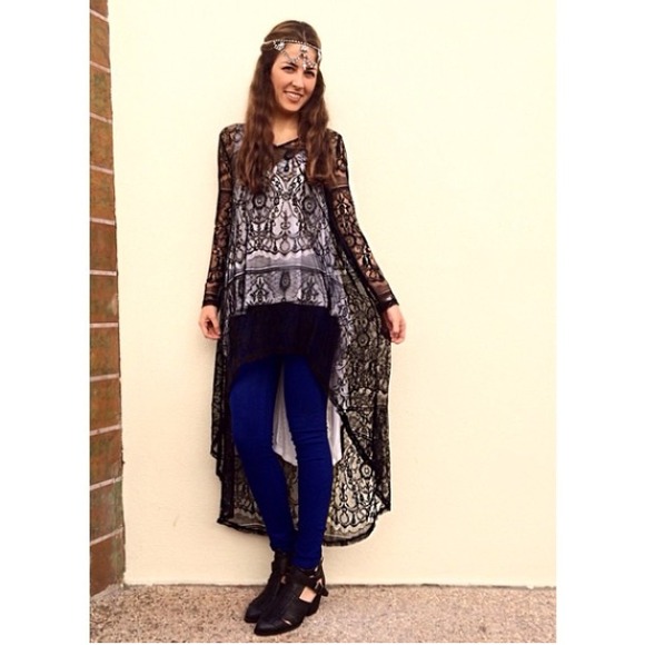 LF Dresses & Skirts - LF lace dress coverup