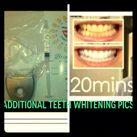 More pics of my teeth whitening kits