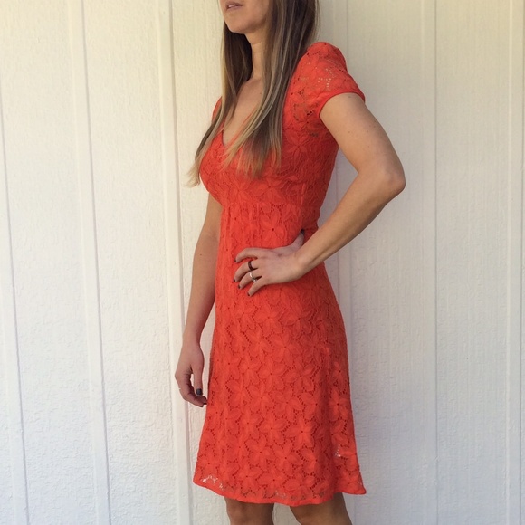 Lace dress - Picture 2 of 3