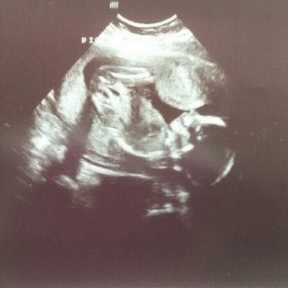 It's a girl