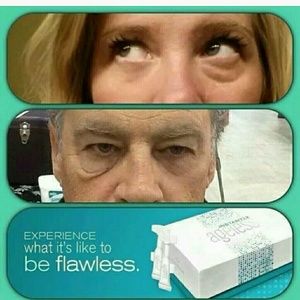 Instantly Ageless (5 Vials)
