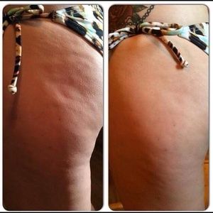 Body cream (body contouring cream)