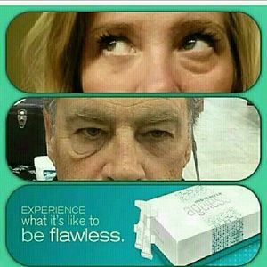 Instantly Ageless (5 Vials)
