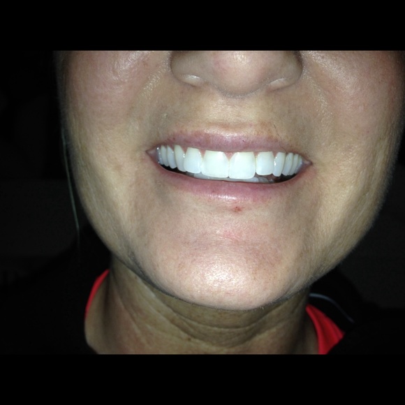 Teeth whitening rinse - Picture 3 of 4