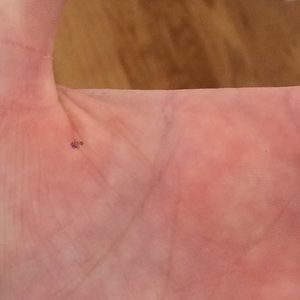 WHAT IS THAT DOT?? in your pics?!?