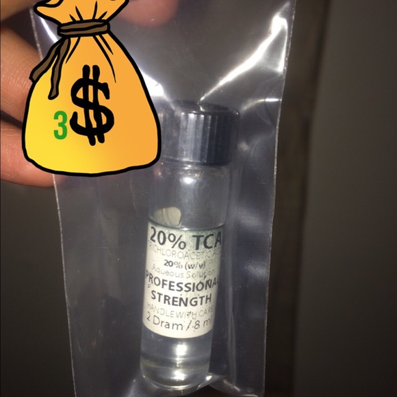 TCA peel 20%