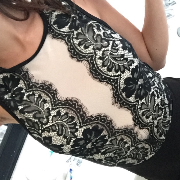 LACE ROMPER ✨ - Picture 4 of 4