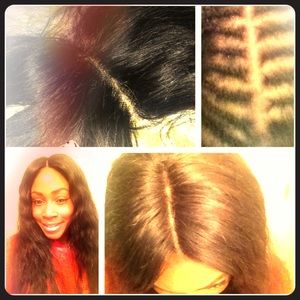 Lace closure
