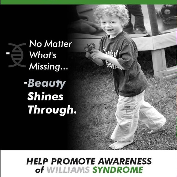 😍MAY IS WILLIAMS SYNDROME AWARENESS MONTH😍 - Picture 2 of 4