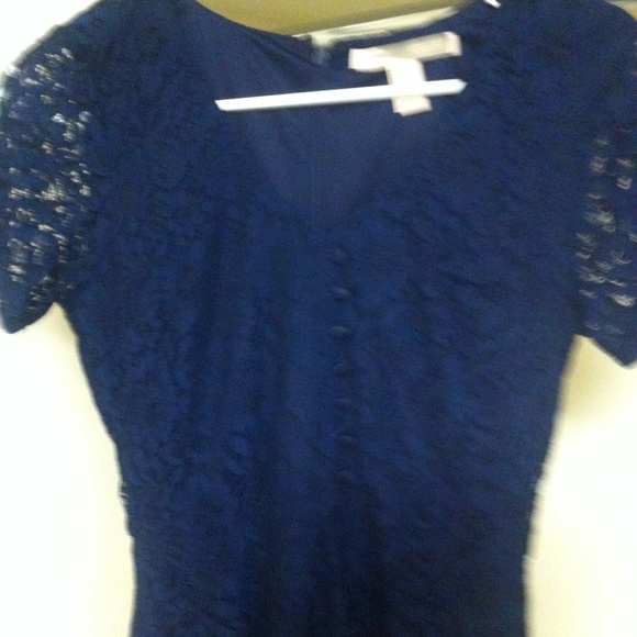 Forever 21 blue lace dress - Picture 2 of 4
