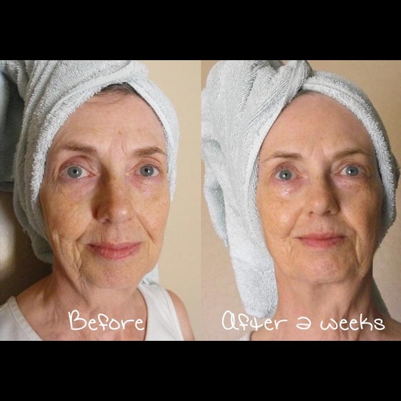 🔴🔴SOLD🔴🔴 - Picture 4 of 4