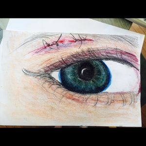 Drawing of eye and stitches 🌸🌵