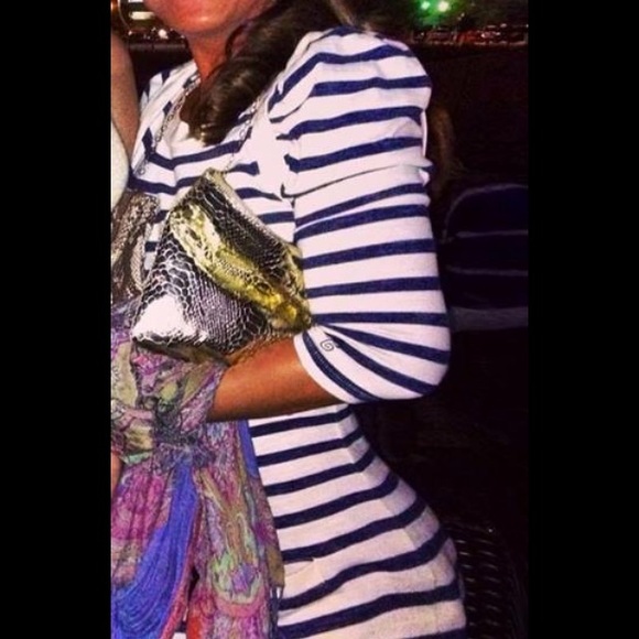 Striped Dress on the right