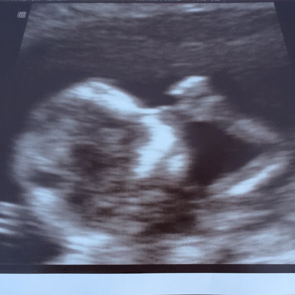 💕MEET THE SELLER PART✌🏽 - Picture 5 of 8