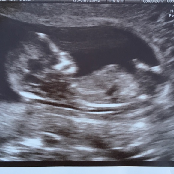 💕MEET THE SELLER PART✌🏽 - Picture 6 of 8