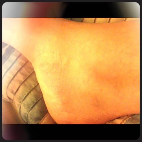 Pneumonia sprained ankle holiday delay ship
