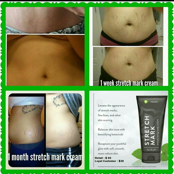 Stretch mark cream