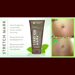 Stretch mark cream!!!!