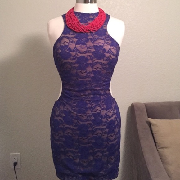Dresses & Skirts - Sexy Blue Lace Dress💙