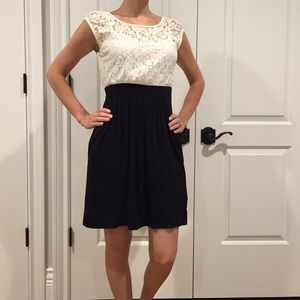 Black and white lace dress
