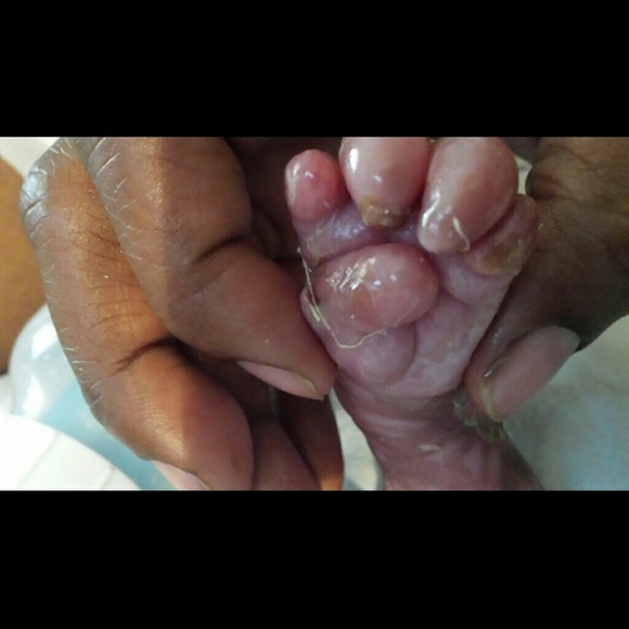 My lil guy 6/5/15 - Picture 2 of 4