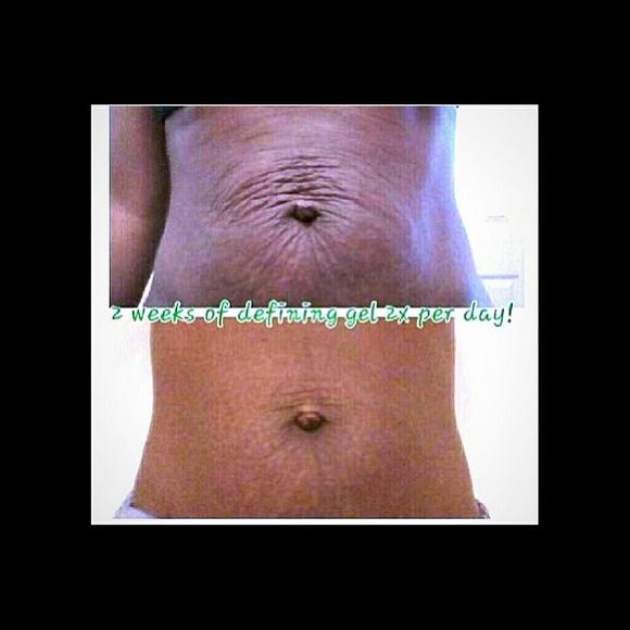 3gram Stretch mark Cream & 3gram Defining Gel set!