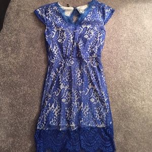 👗Blue Lace Dress !!!!