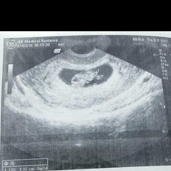 I'm having a baby!!!