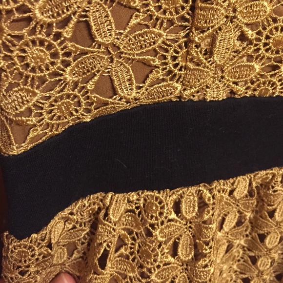 Forever 21 dress - Picture 2 of 4