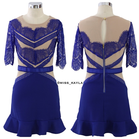 Elegant Blue Lace Dress - Picture 2 of 4