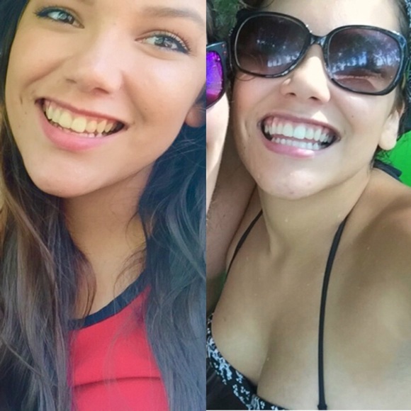 DIAL•A•SMILE teeth whitening kit - Picture 4 of 4