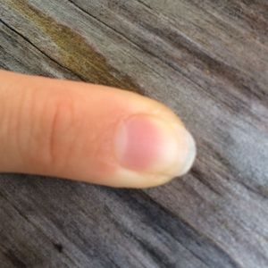 Finger Nail