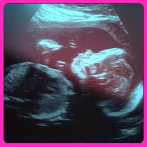 Meet your Posher, Alec