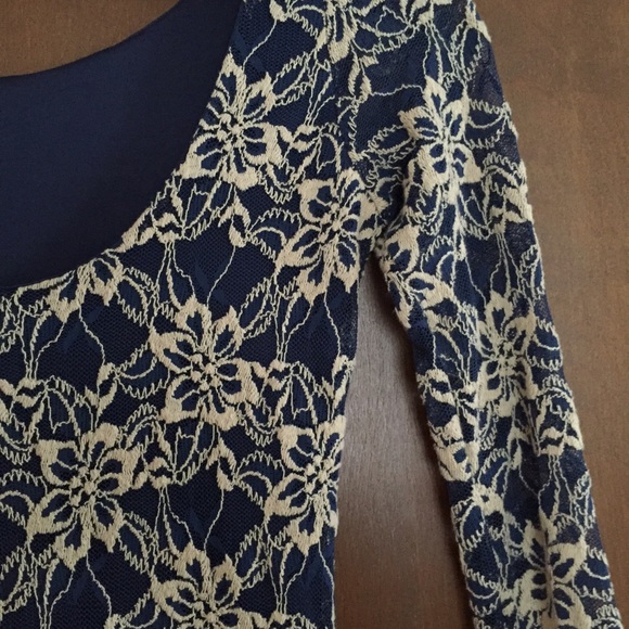 Mid length floral lace dress