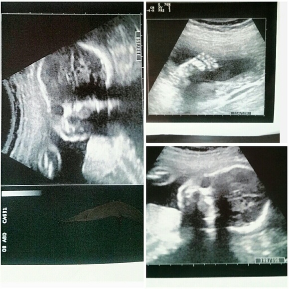 Meet your Posher, Hazel - Picture 3 of 5