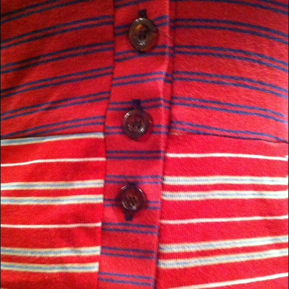 💋Urban Renewal Striped Tank Dress W/Button Front - Picture 4 of 4