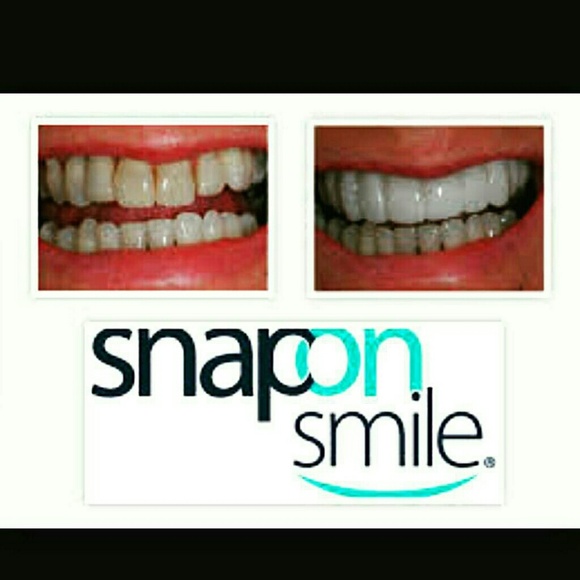 gold teeth grill, snap on smile veneers - Picture 3 of 4