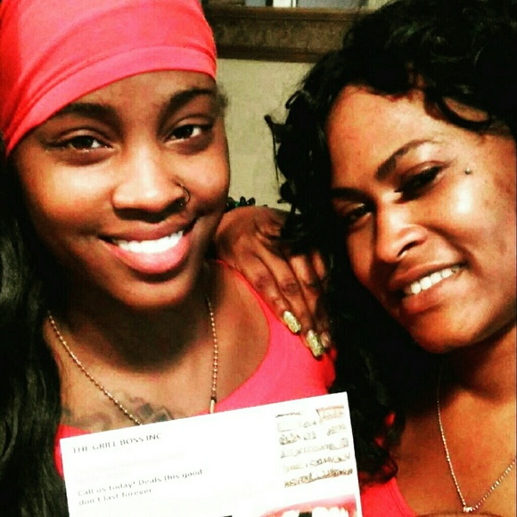 gold teeth grill, snap on smile veneers - Picture 4 of 4