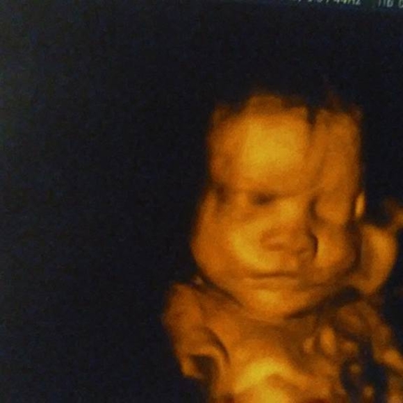 Meet your Posher, Ale - Picture 1 of 1