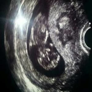 Meet your Posher, Shane