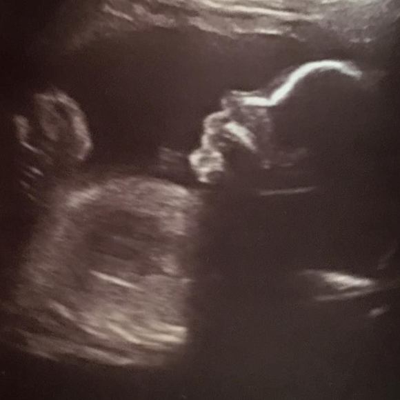 Meet your Posher, Megan - Picture 1 of 1