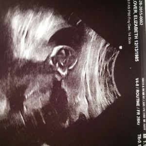 Meet your Posher, Labrae